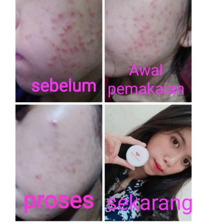 C20H MAXIE GLOW SKINCARE () -SKINCARE  RESMI BPOM 