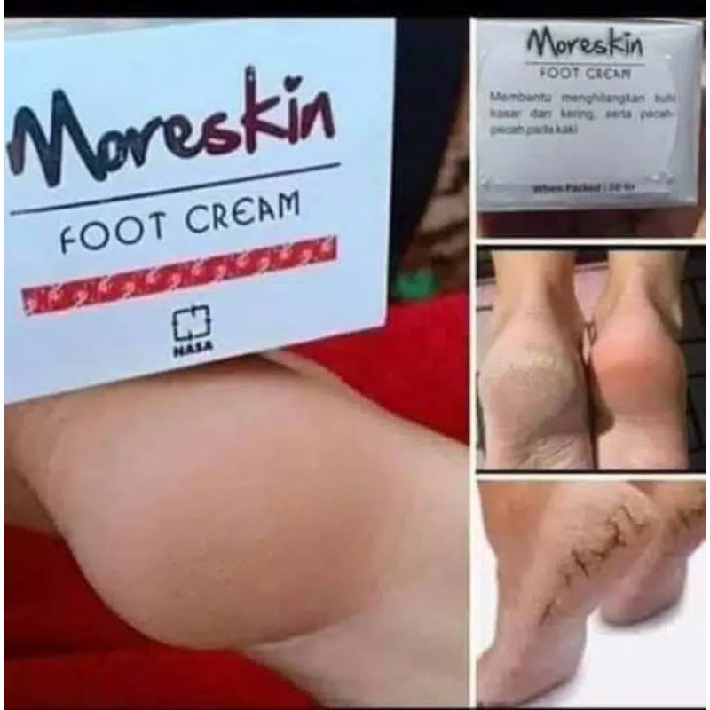 Obat kaki pecah2 - Obat kaki pecah dan kering  - Food Cream Nasa - Cream kaki pecah2 - Cream kaki