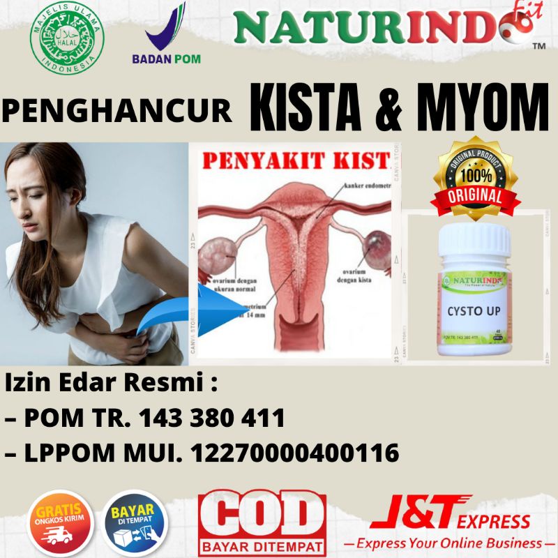 Obat Herbal Penghancur Kista Myom Miom Benjolan Kista Bartolin