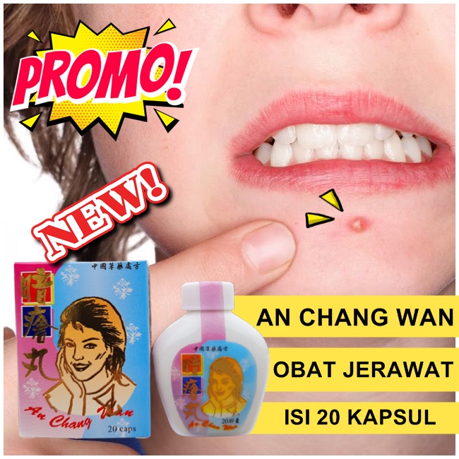 PROMO Kapsul penghilang jerawat an chang wan original obat jerawat china ampuh terbaru