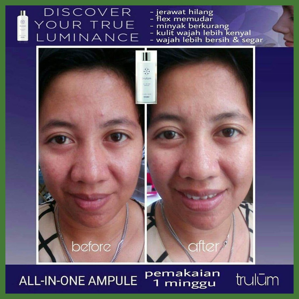 Cream Penghilang Jerawat Pemutih Wajah Trulum Pemutih Wajah Cepat