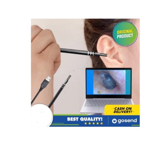 Korek Kuping Anak Dengan Kamera | Korek Kuping Dengan Kamera