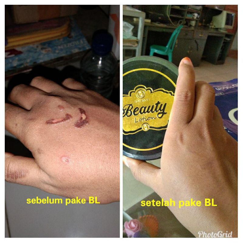 BEAUTY LOTION DAN BEAUTY SCRUB ORIGINAL RK COSMETICS PENCERAH ALAMI KULIT BPOM