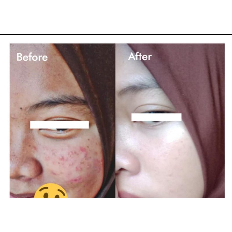 SERUM WHITENING ANGGUR COLLAGEN 5X LEBIH PUTIH