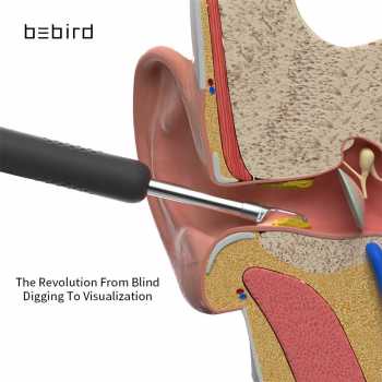 Korek Kuping Stick Kamera Endoscope Pembersih Telinga Smart Visual Ear Pick 300W