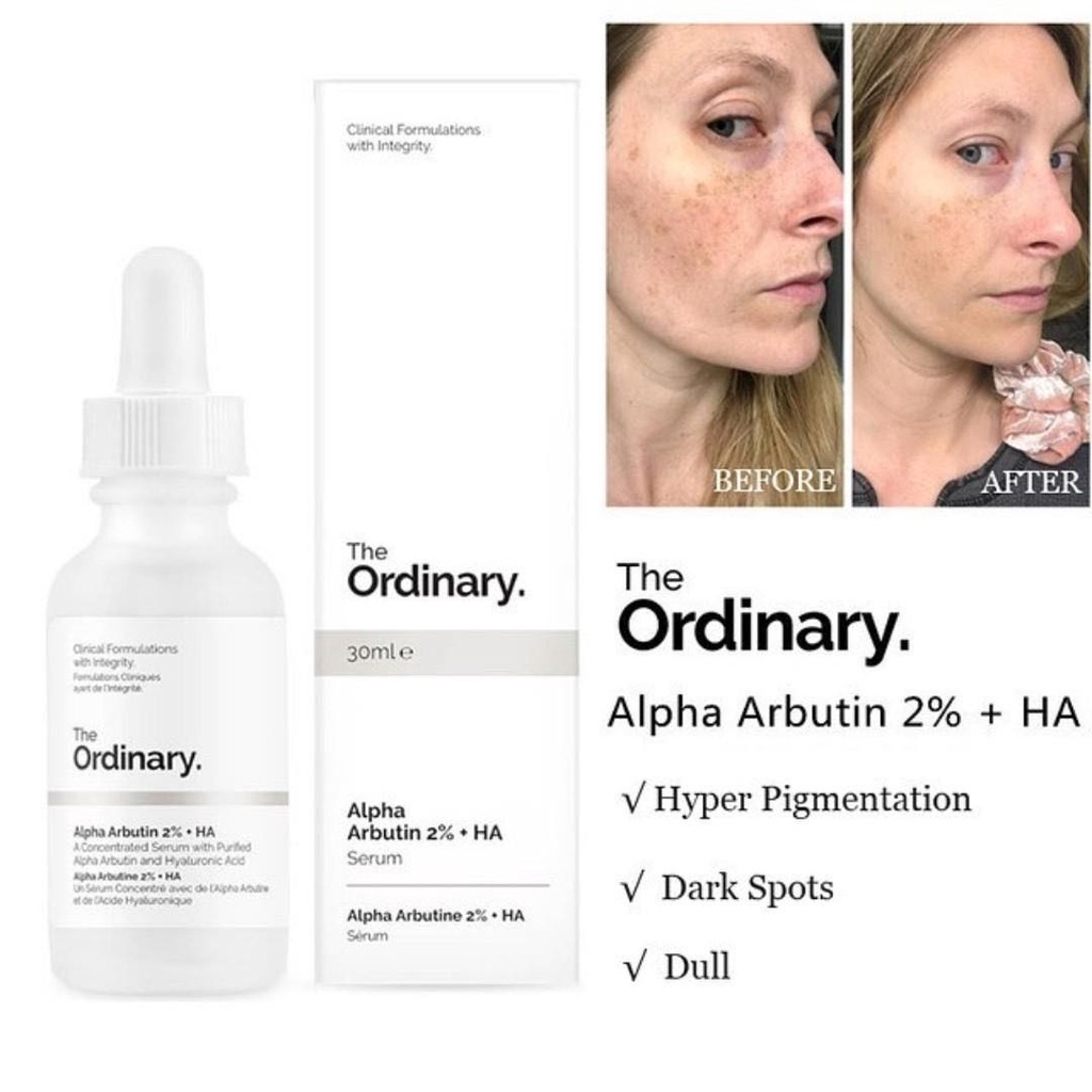 The Ordinary Alpha Arbutin 2% + HA 30ml