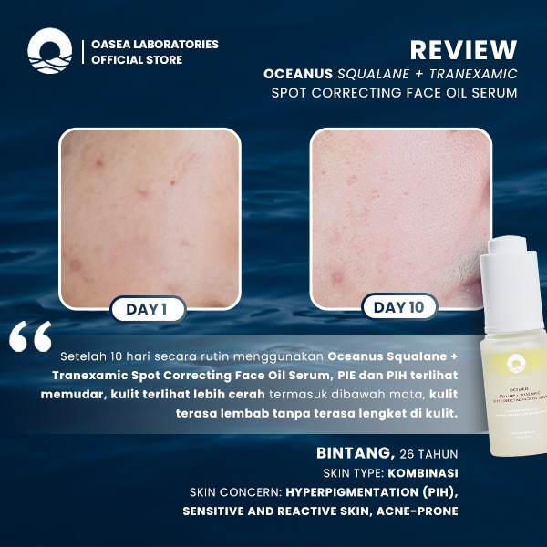 Oasea Oceanus Squalane + Tranexamic Spot Correcting Face Oil Serum 20 ml