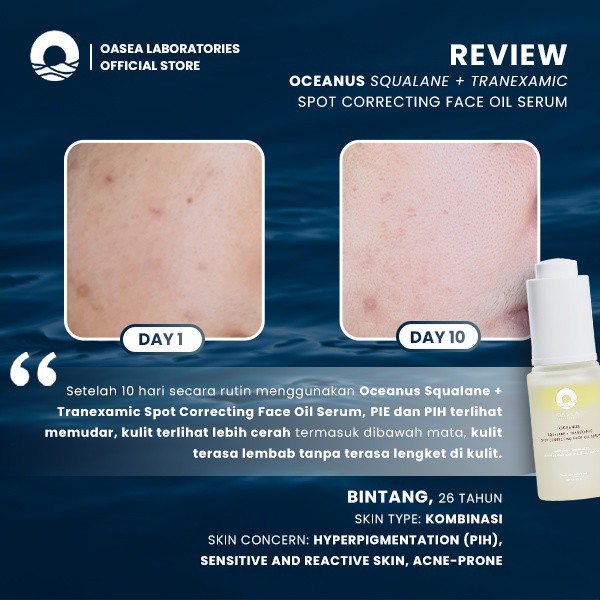 Oasea Oceanus Squalane + Tranexamic Spot Correcting Face Oil Serum 20 ml