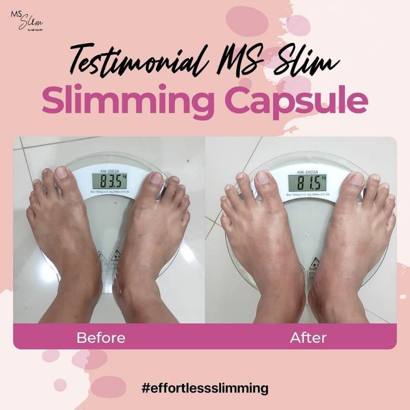 Ms Glow Slimming Capsule Pelangsing Badan