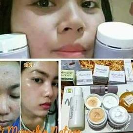 Star Seller,✷ Moreskin Nature Paket | Paket Perawatan Wajah| Nature Nasa | Produk Nasa | Agen Nasa