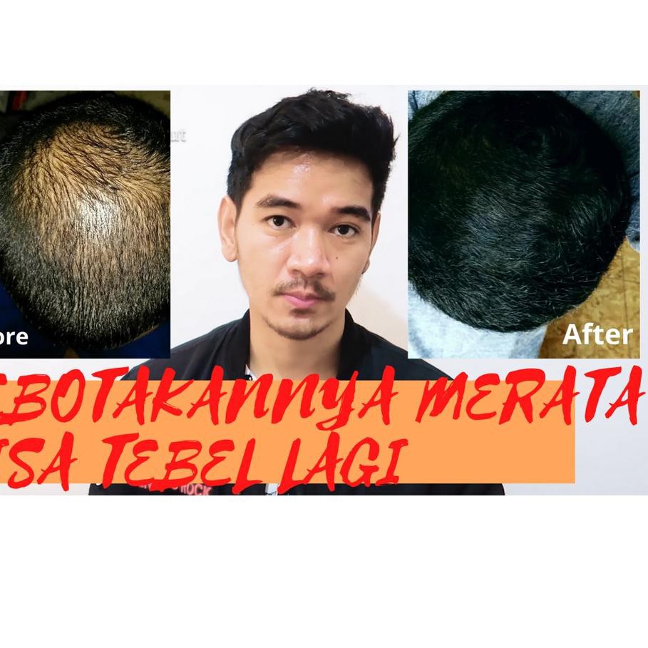 ►k-64 BIG 3 SPESIALIS RAMBUT (FINAS PURE ORAL 1MG) 