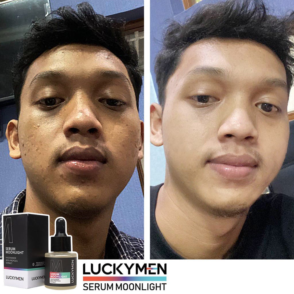 ( BONUS PARFUM ) LUCKY MENS SERUM MOONLIGHT Pencerah wajah pria/serum pria/serum wajah pria