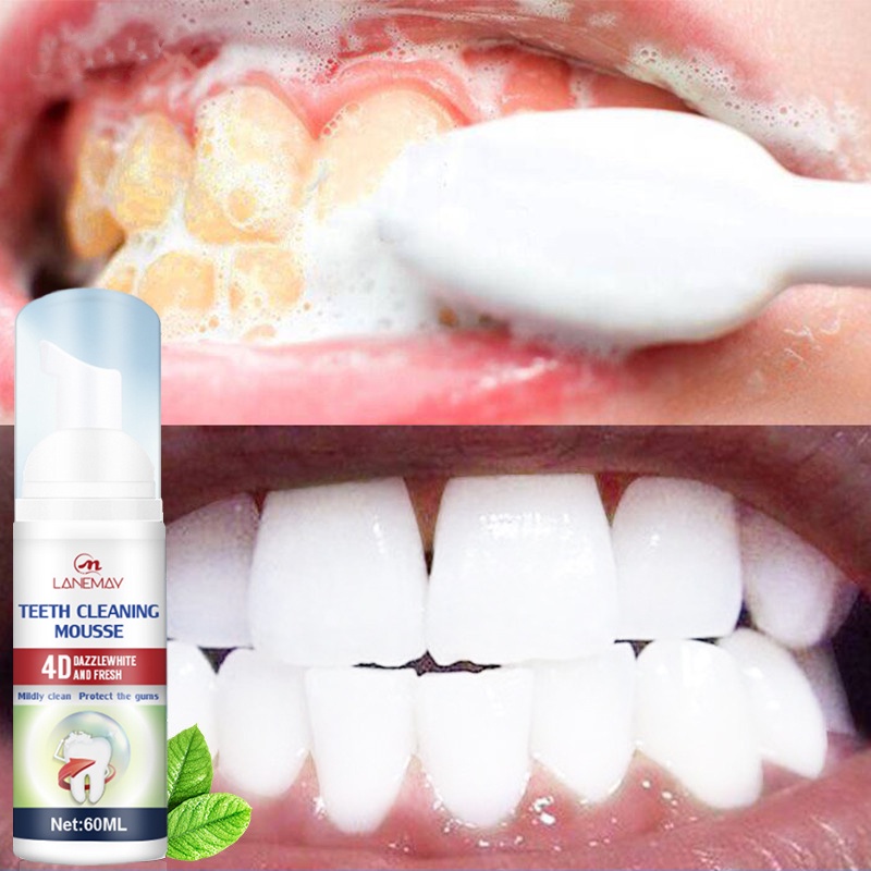 Pasta gigi whitening Gigi putih Whitening toothpaste Pasta gigi pemutih gigi Odol pemutih gigi dan karang gigi Mousse Pemutih Gigi Pembersih Mulut Pasta Gigi Berbusa Nafas Segar Menghilangkan plak dan gigi berlubang