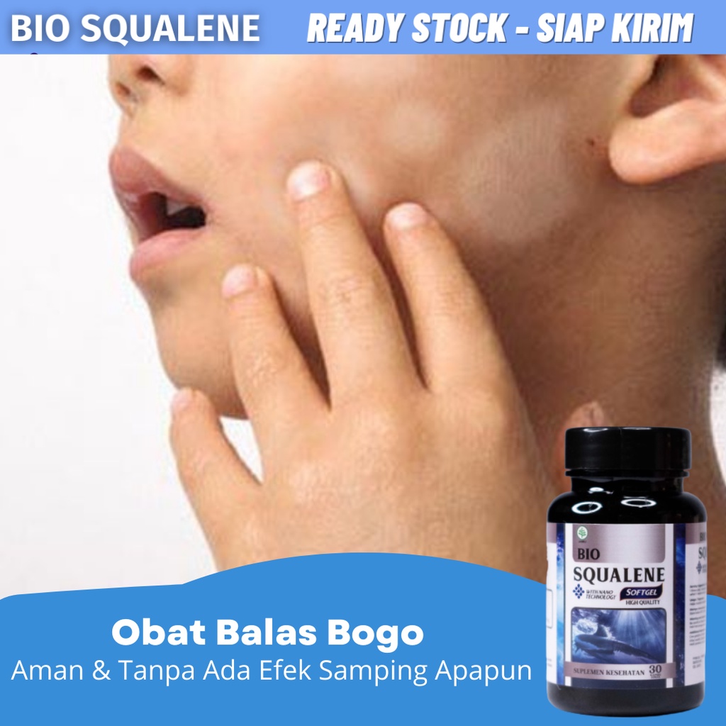 Obat Balas Bogo, Obat Penghilang Balas Bogo, Obat Panu di Wajah, Obat Hapuran Kulit, Obat Penghilang