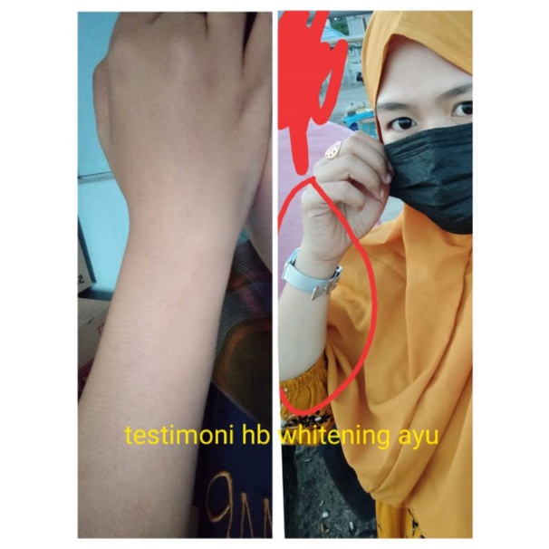 HbAyu150ml