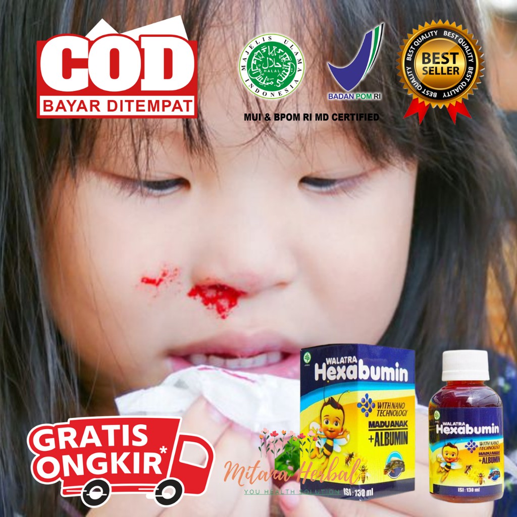 Jual MIAL Obat Mimisan Pada Anak, Obat Anak Mimisan, Obat Sering