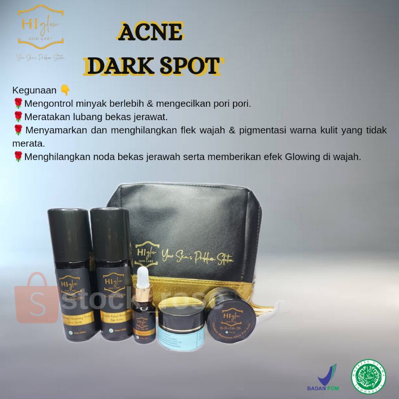 ACNE DARK SPOT / HI GLOW ACNE / KRIM JERAWAT / KRIM PEMUTIH / KRIM BPOM / HI GLOW