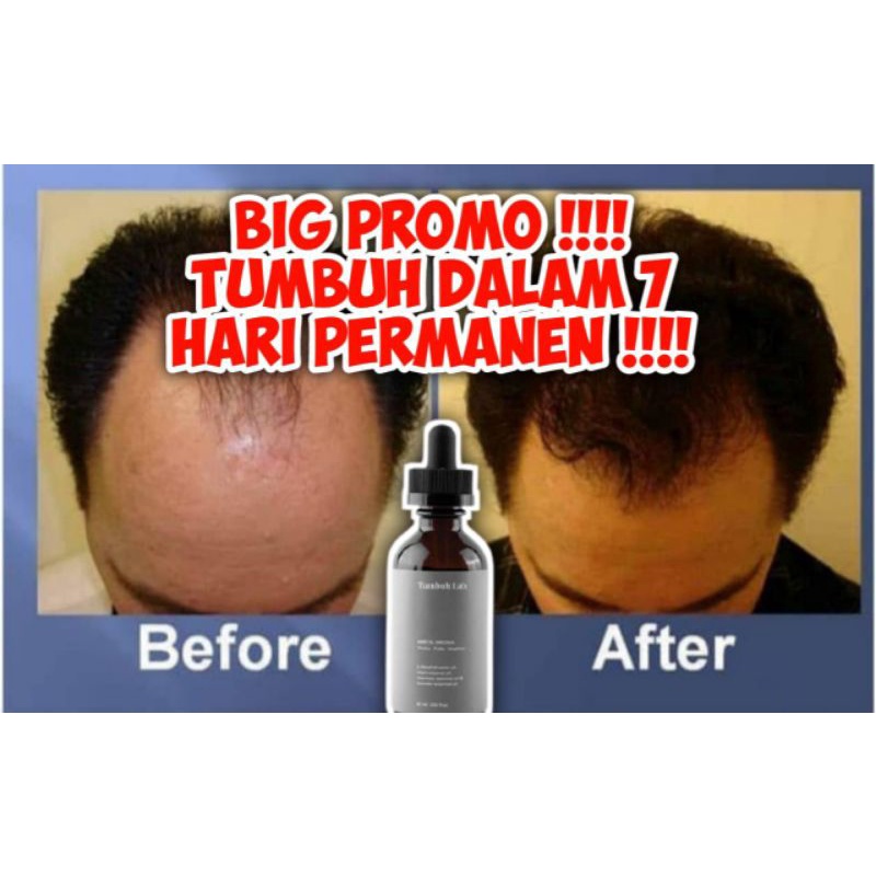 TUMBUH LAB *PAKET SILVER*