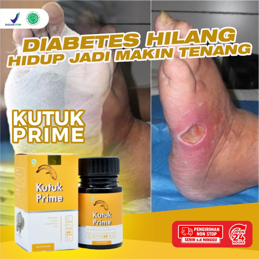 Kutuk Prime Original – 100% Ekstrak Ikan Gabus 3x Lebih Cepat Sembuhkan Luka Diabetes Cepat Keringkan Luka Operasi Turunkan Kadar Gula Cegah Infeksi Pada Luka Cegah Keloid Atasi Luka Bakar Kecelakaan