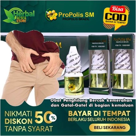 Obat Penghilang Bercak kemerahan dan Gatal-Gatel di bagian kemaluan | Herbal Salep Oles reaksi alerg
