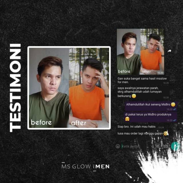 MS Glow For Men Basic - 3 item-4