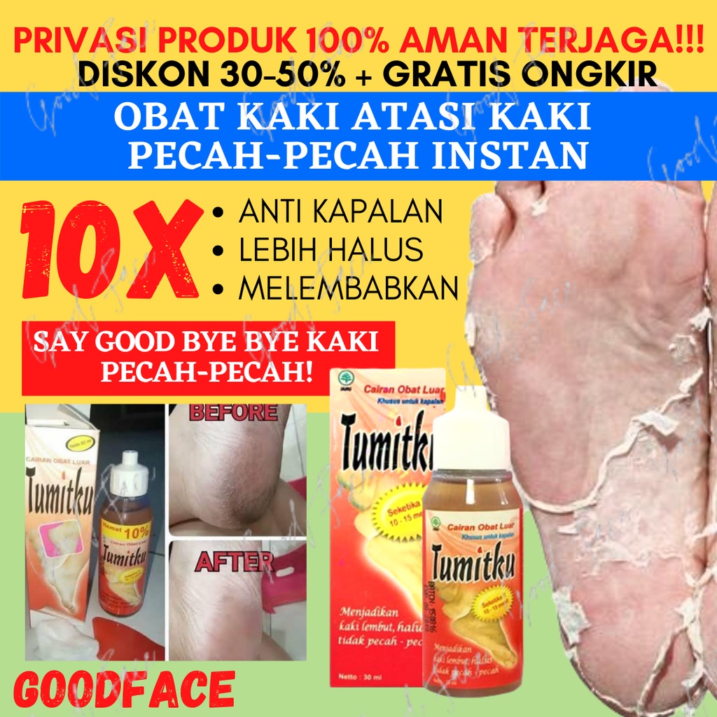 TUMITKU 30ml ORIGINAL OBAT HERBAL PENGHALUS TUMIT AMPUH