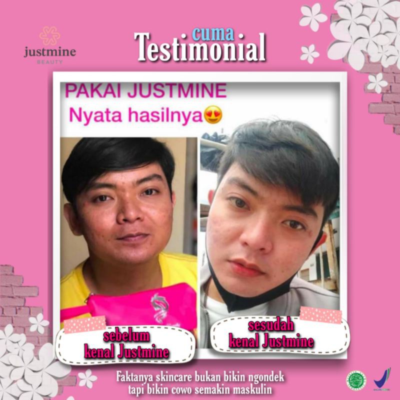 Justmine Beauty Skincare Original paket Remove/Acne More/Ultima Bpom Mengatasi Jerawat, Flek Hitam dan Kulit Sensitiif-7