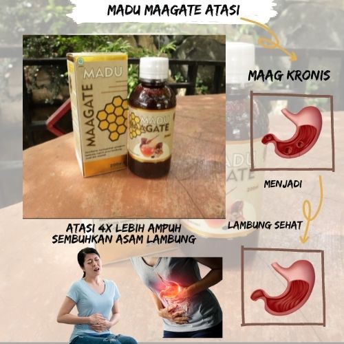 Madu Maagate Obat Herbal Atasi Sakit Maag / Atasi Asam Lambung