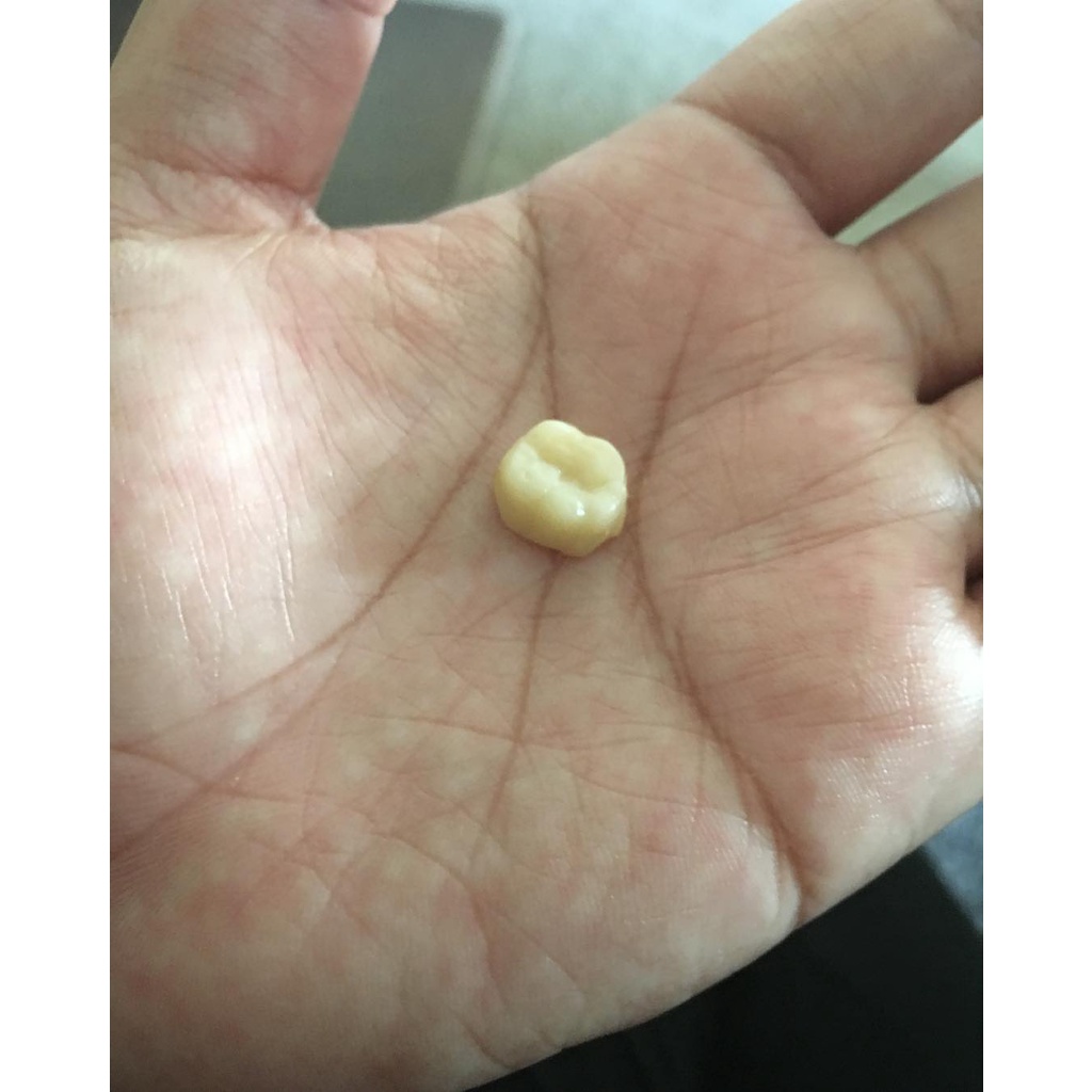 SANGAT KUAT Gigi Palsu Penutup Ompong Depan Bawah Penambal Gigi Ompong Berlubang Patah Temptooth Tem