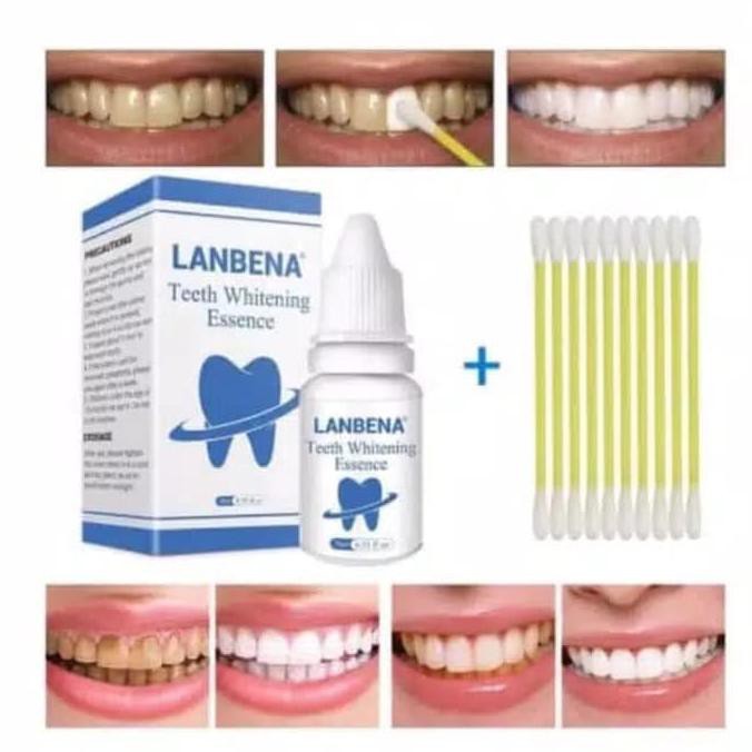 How much does teeth whitening cost in south africa