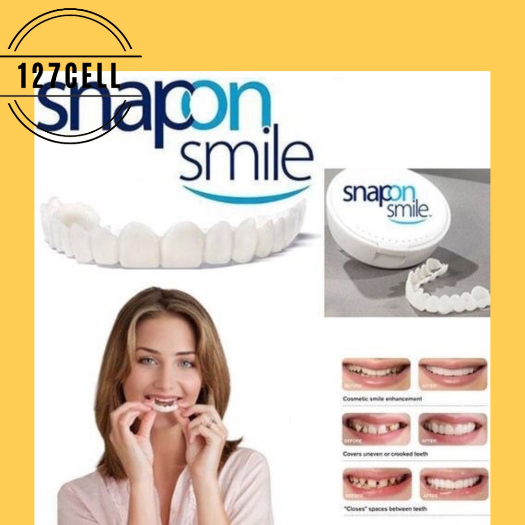 Snap On Smile 100% Original Authentic Gigi Palsu 1 Set Atas Bawah JAMINAN ORI BUKAN BARANG PALSU