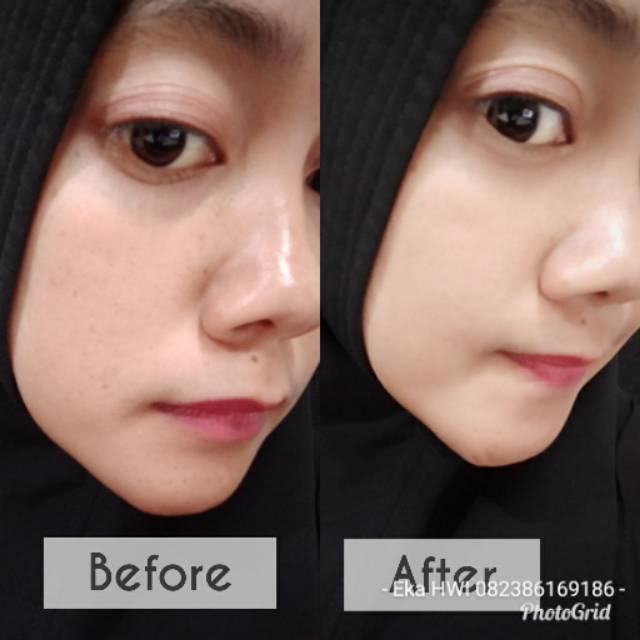 Prime skin Cream T2T