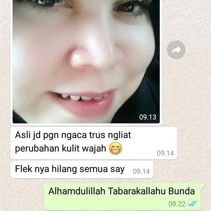 [100% Asli] Cream Walet Siang Super White Pemutih Wajah Penghilang Jerawat Penghilang Flek Hitam