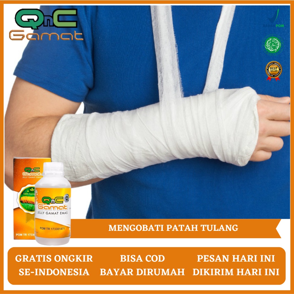 Obat Patah Tulang, Obat Patah Tulang dan Retak, Obat Patah Tulang Tangan, Obat Patah Tulang Kaki, Ob