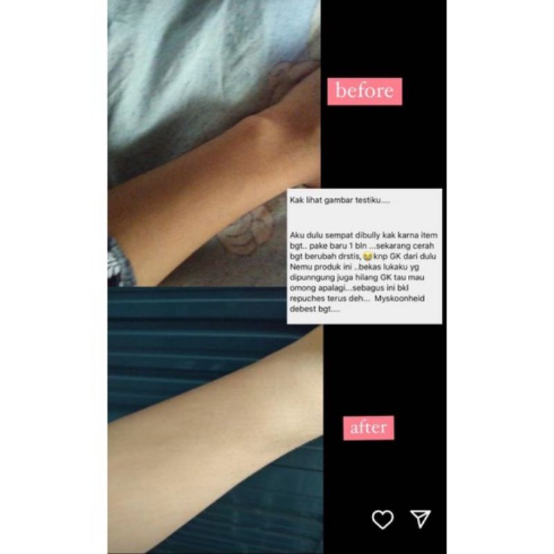 lotion my skoonheid FREE GIFT exp date terbaru (handbody pemutih ampuh dan viral)