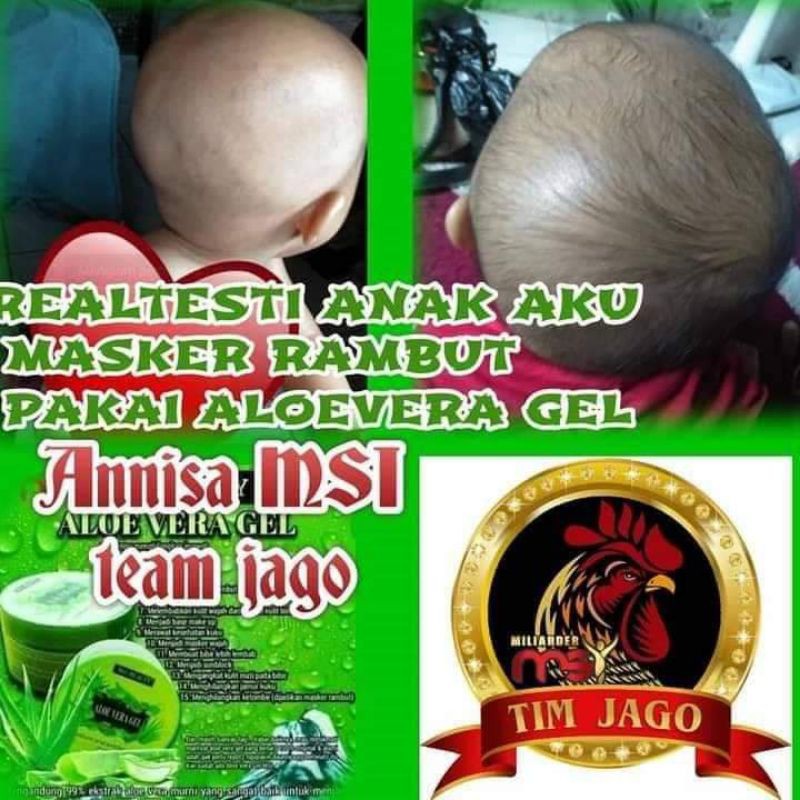 Allovera gell (Original produk MSI 100%)