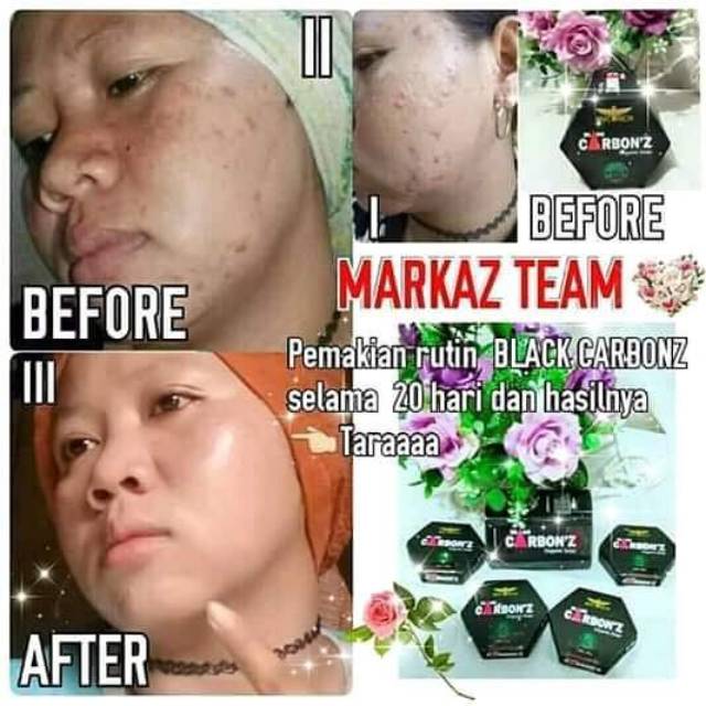 Black carbonz organik soap