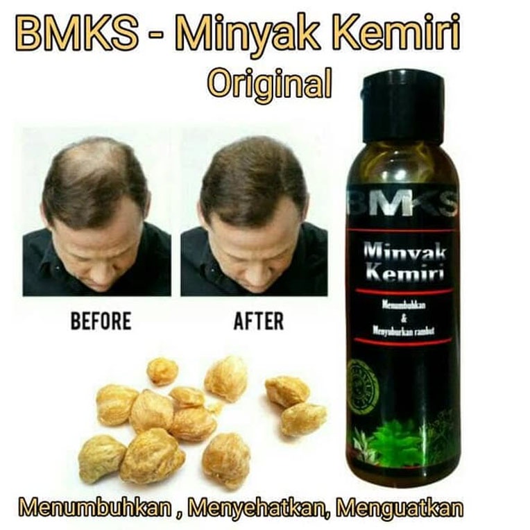 BMKS Minyak Kemiri / Black Magic Minyak Kemiri