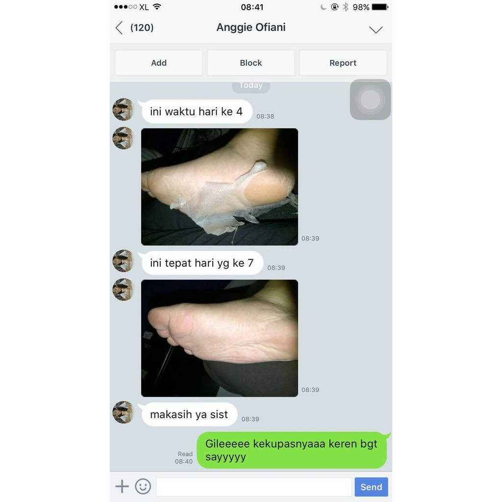 PROMO - READY STOCK HANAKA BABY FOOT KULIT KAKI TUMIT PECAH-PECAH PERAWATAN KAKI