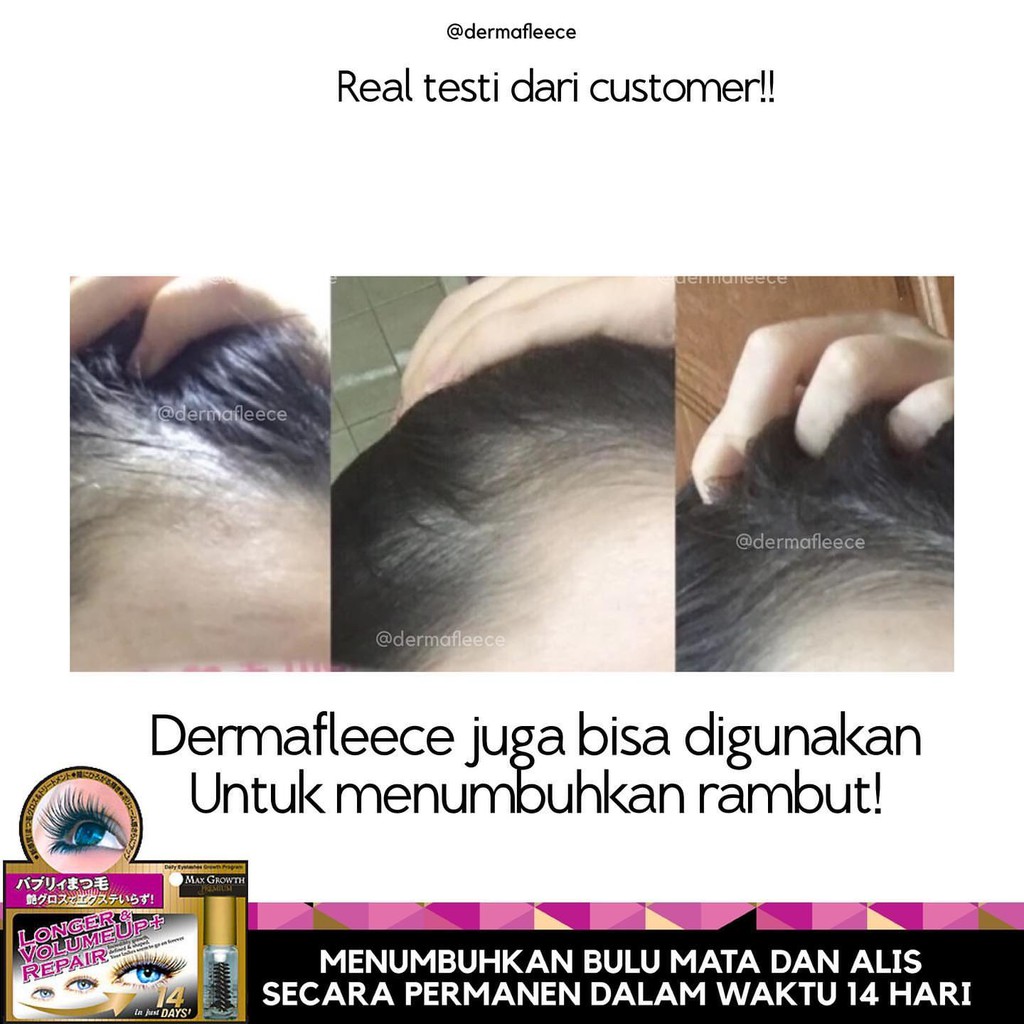 Dermafleece Max Growth Premium(5ml) - EXP:12/2023 Serum Bulu Mata/Penumbuh Bulu Mata/Alis