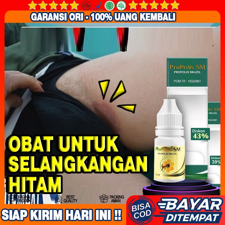 Obat Selangkangan Hitam, Selangkangan Gatal Gatal, Selangkangan  Hitam Dan Gatal Gatal Dekat Kelamin