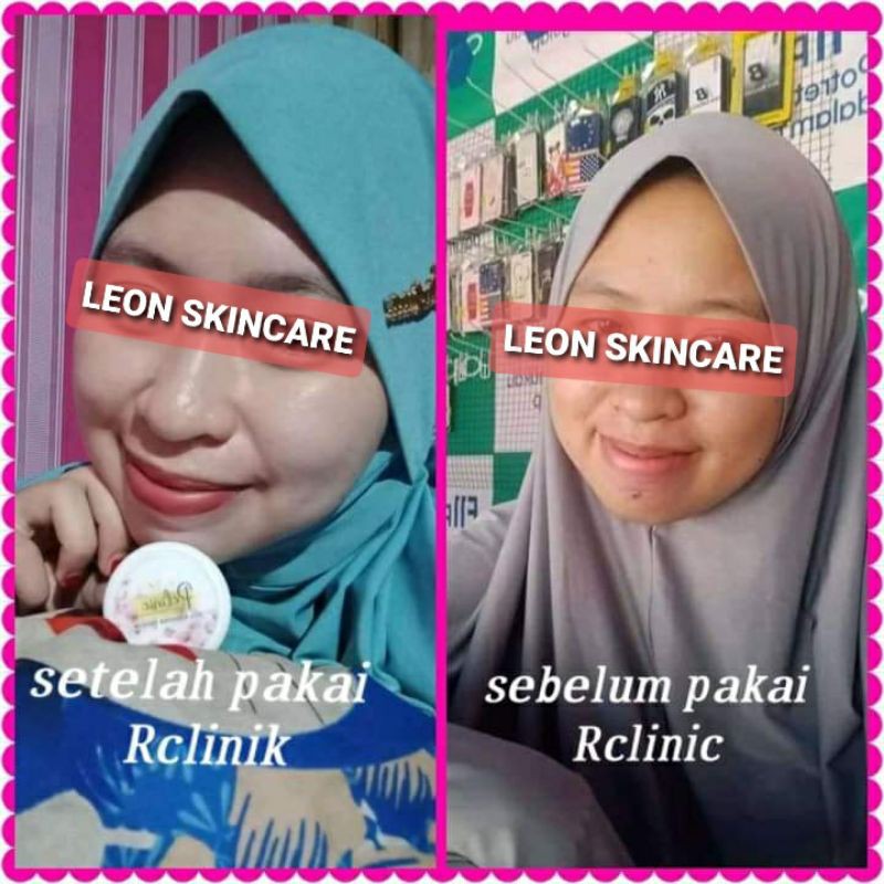 SALEP PELICIN WAJAH GLOWING (RCLINIC DOKTER)