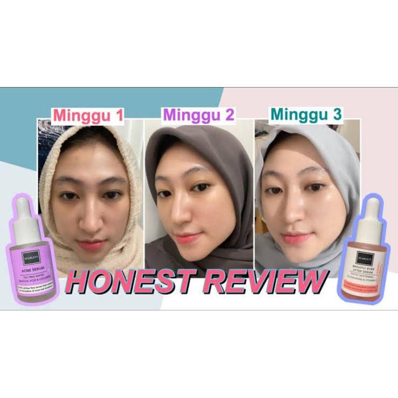 SCARLETT BRIGHTENING SERUM ACNE DAN SERUM BRIGHTLY - SCARLET BY FELICYA ANGELISTA