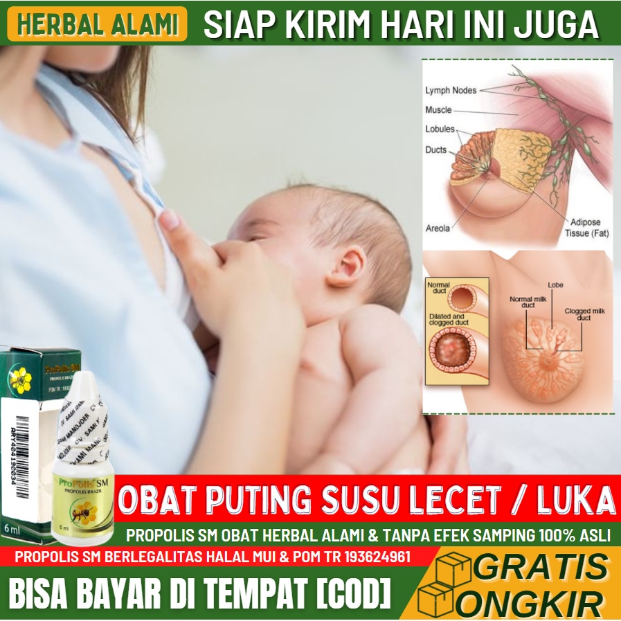 Obat Puting Susu Lecet 100% Alami Aman Untuk Bayi, Obat Salep Luka di Puting, Pengering Puting Susu 