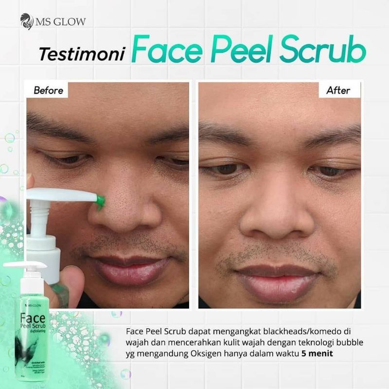 FACE PEEL SCRUB MSGLOW ANGKAT BLACKHEADS KOMEDO EKSFOLIASI