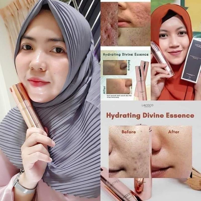 penghilang bopeng |penghilang bekas jerawat |lacoco nasa | produk viral