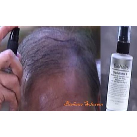 Bio Hair - Biohairs solution - Serum Penumbuh Rambut Botak