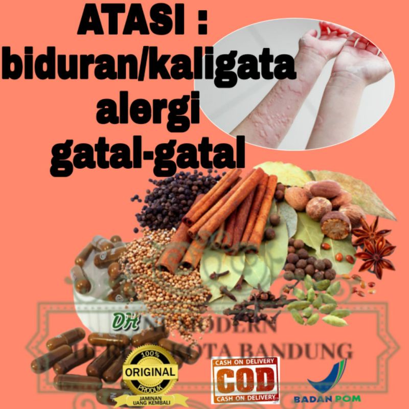 Obat Gatal Kulit Paling Ampuh  Alergi Gatal Kulit Biduran Kaligata Herbal BPOM Hepatifit Naturindo