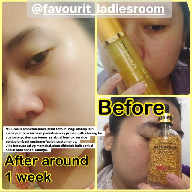 Paket 24Knpure gold & Purarose gold stem C