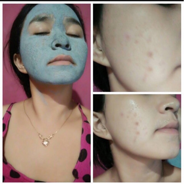 MS Glow Green Tea Clay Mask / Masker Wajah MSGlow Greentea Termurah Original Asli Terbaru BPOM